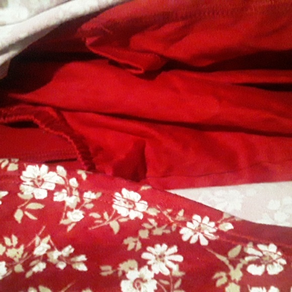 Hollister Dress Romper size XS - Picture 5 of 10